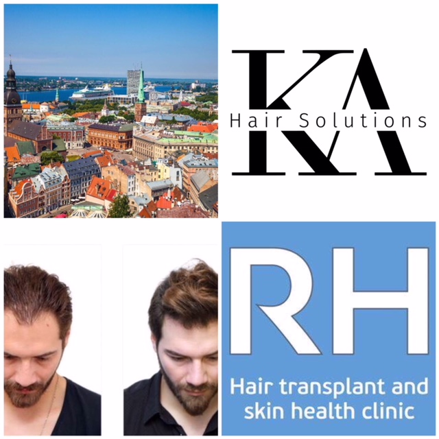 KA Hair Solution and Rubenhair Baltics logos