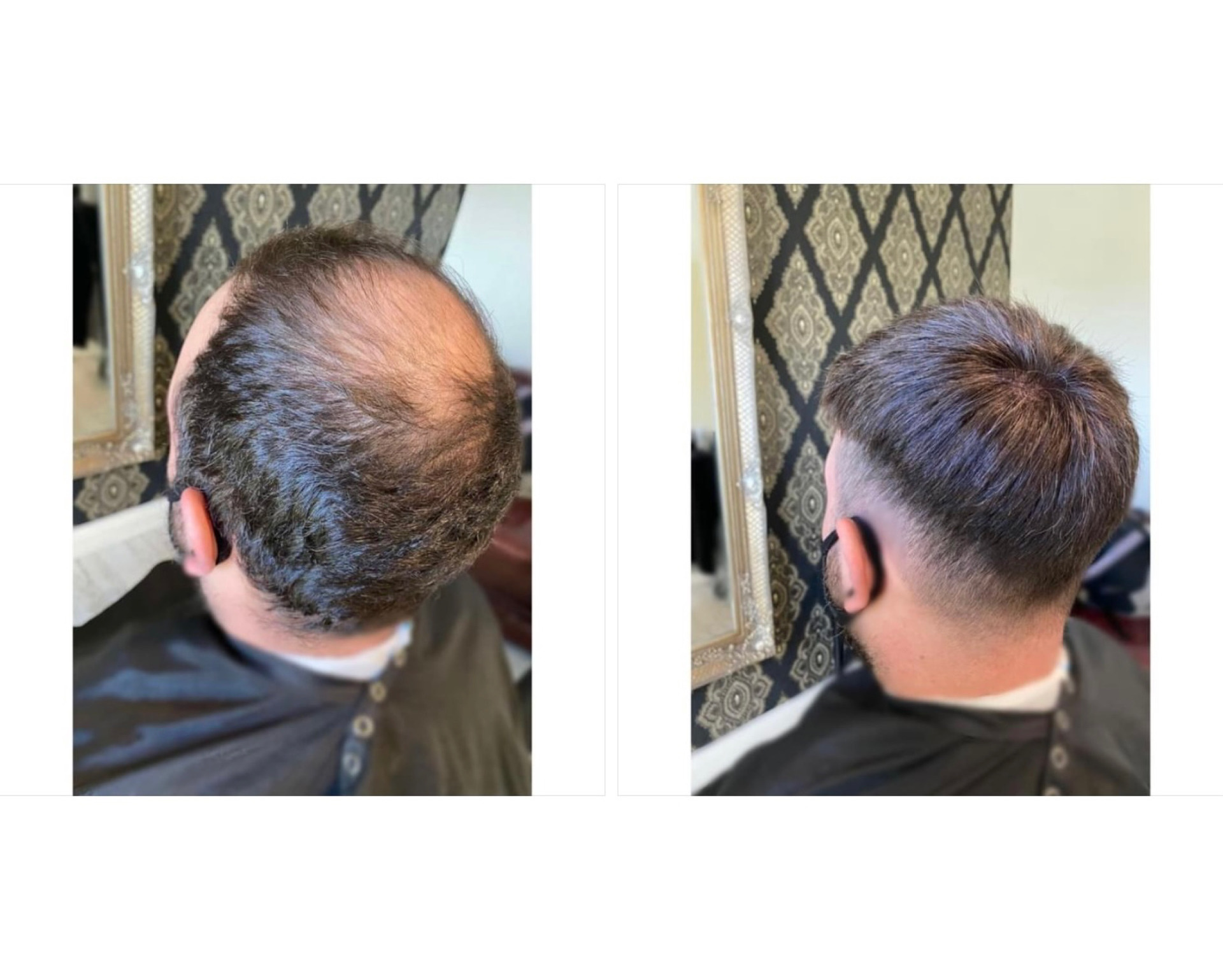 Mens hair system fitted by KA Hair Solutions Ireland