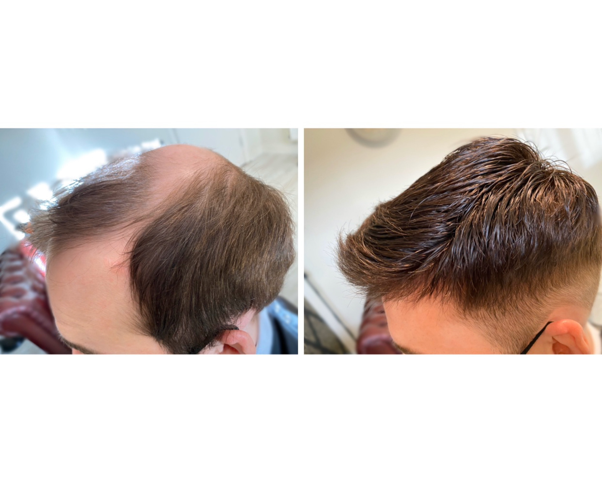 Man receiving a new hair piece at KA Hair Solutions studio in Dublin
