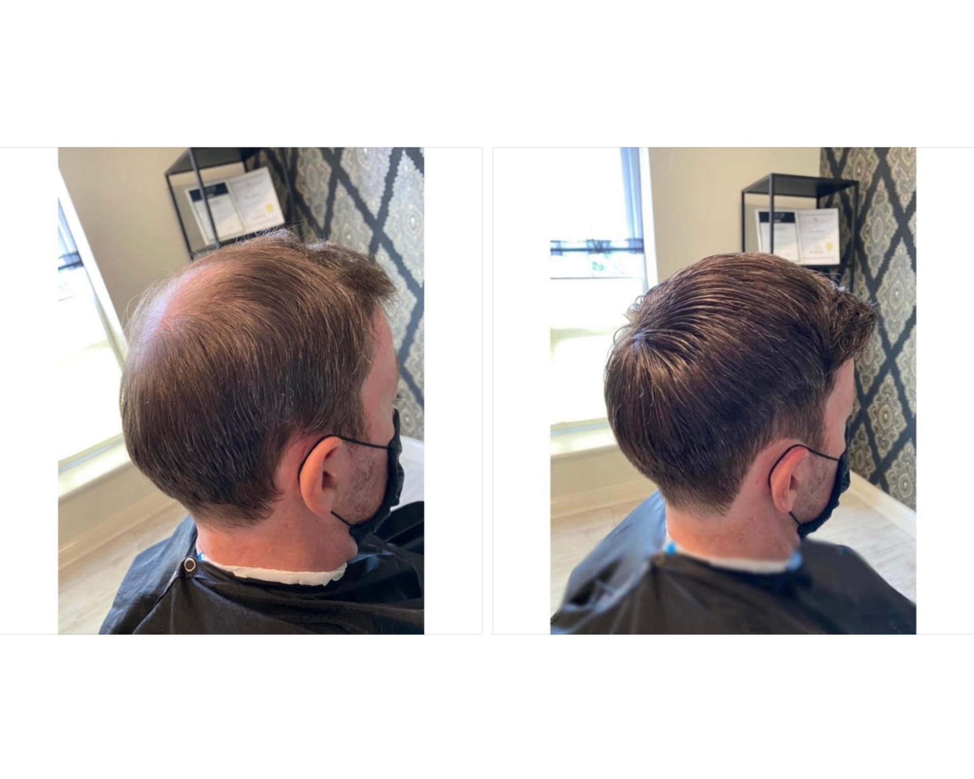 KA Hair Solutions before and after image